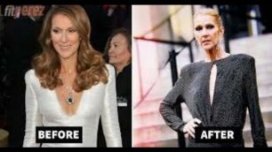 'Celine dion weight loss reason: The basic truth about my Weight loss.'