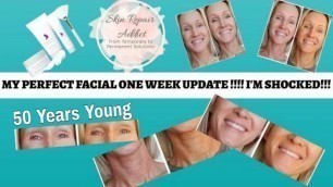 'My Perfect facial  -1 Week Update and Progress'