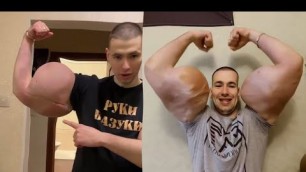 'Russian Hulk Shows Off His Big Fake Arms'