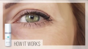 'Learn How My Perfect Eyes Works'