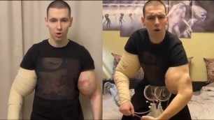 'Russian Kid Gets His Arms Drained AGAIN'