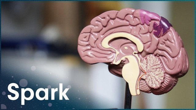 'What Happens To The Brain In Old Age? | The Brain Fitness Program | Spark'