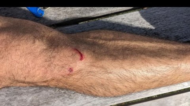 'I almost died | Freaky gym accident #gymfails #fitness #bodybuilding #crossfit #powerlifting Pt 2'