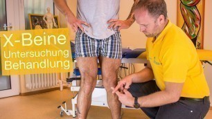 'X-Beine ❌ Was wirklich hilft: Ursachen | Untersuchung | Therapie (OP) | Übungen'