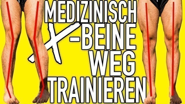 'X BEINE WEGTRAINIEREN Komplette Erklärung und Behandlung 