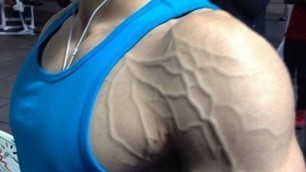 'How To Increase Vascularity Naturally | Workout, Diet & Supplements to Become a Vascular Freak'